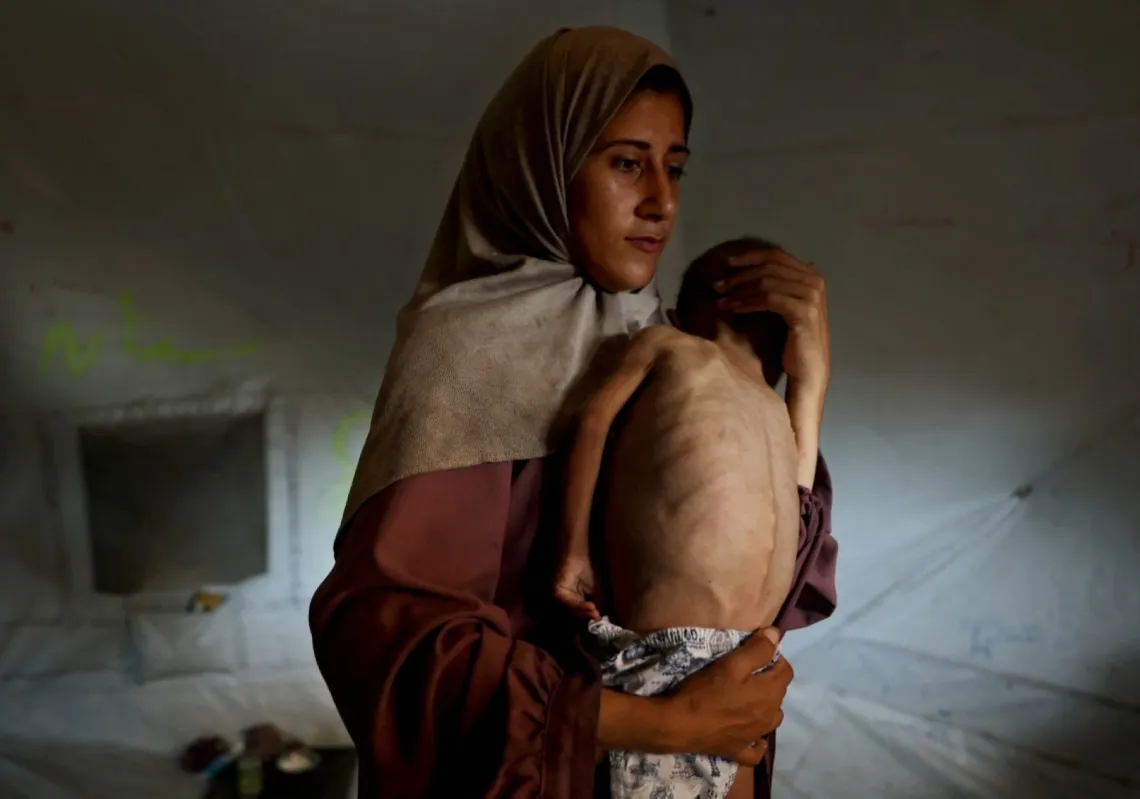 Hidaya, a 31-year-old Palestinian mother, carries her sick 18-month-old son Mohammed al-Mutawaq, who is also displaying signs of malnutrition, inside their tent at the Al-Shati refugee camp, west of Gaza City, on July 24, 2025. 