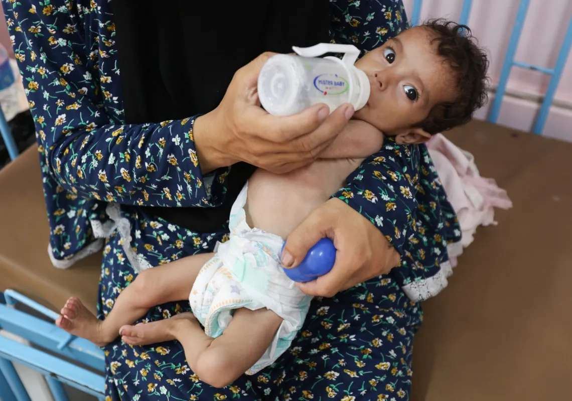 Palestinian woman Najla Abu Aya feeds her five-month-old daughter, Rama, who is malnourished, according to medics, at Nasser Hospital in Khan Younis, southern Gaza Strip, July 24, 2025. 